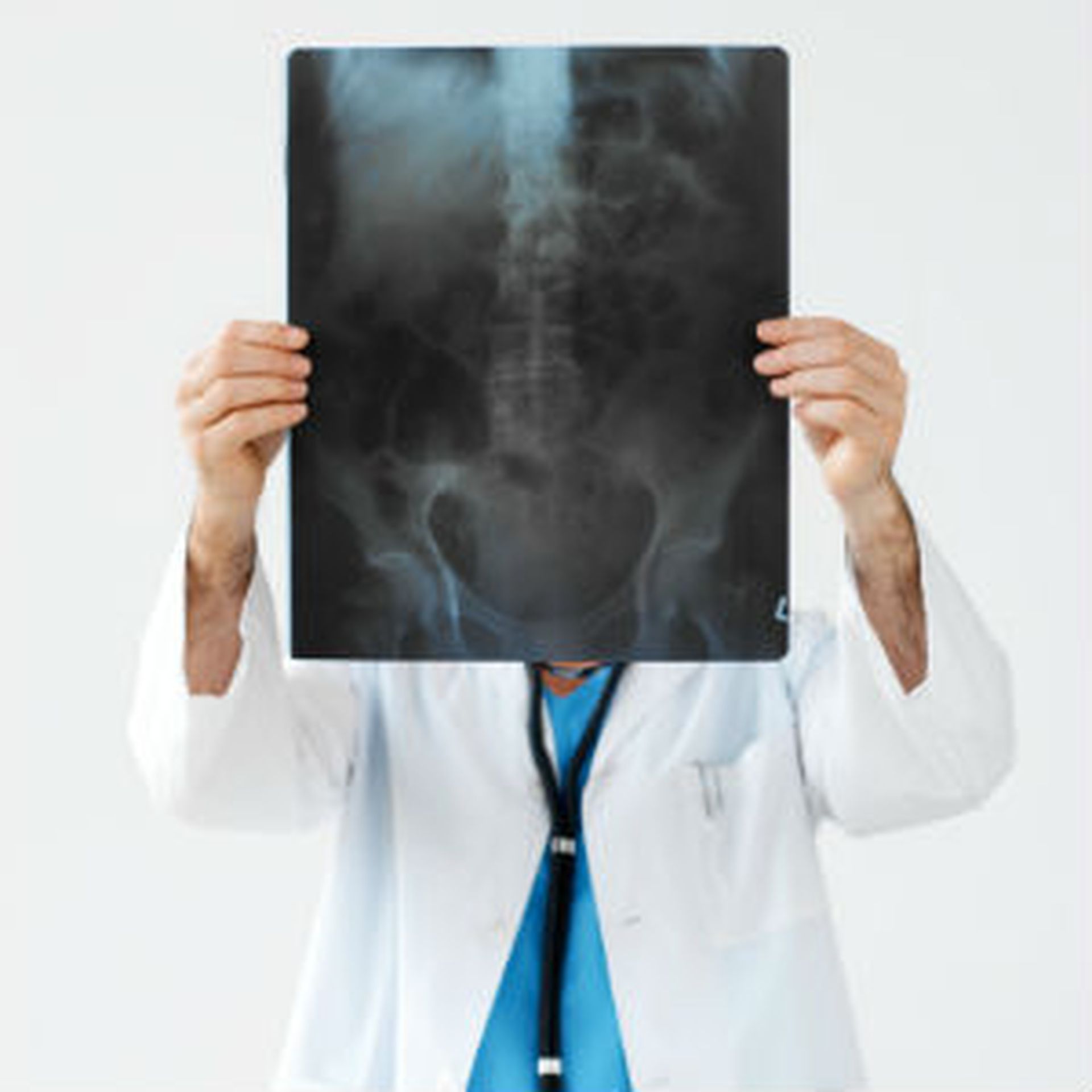 Data on patients may be exposed after X-rays go missing