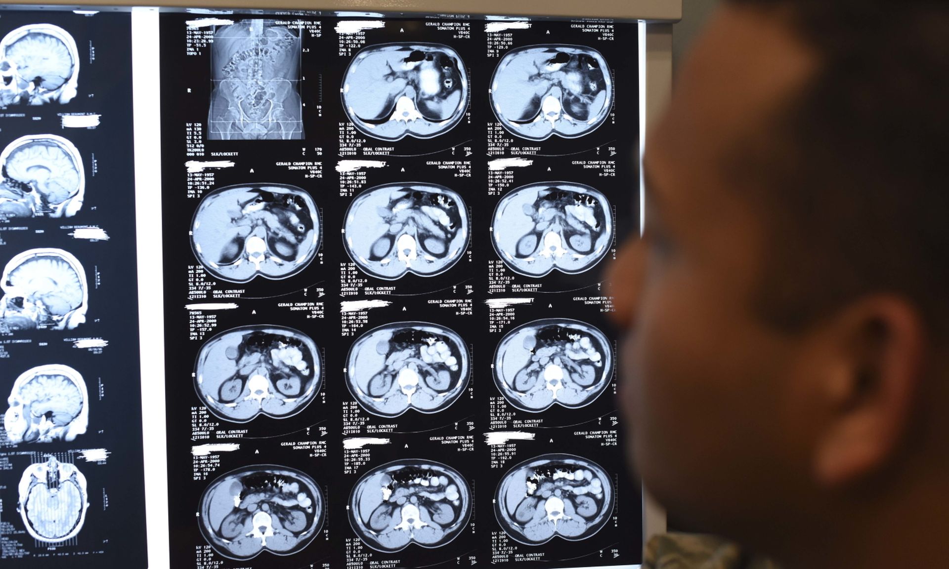 A diagnostic imaging technologist analyzes magnetic resonance imaging and computerized tomography prints on Holloman Air Force Base, N.M. (Staff Sgt. BreeAnn Sachs/Air Force)