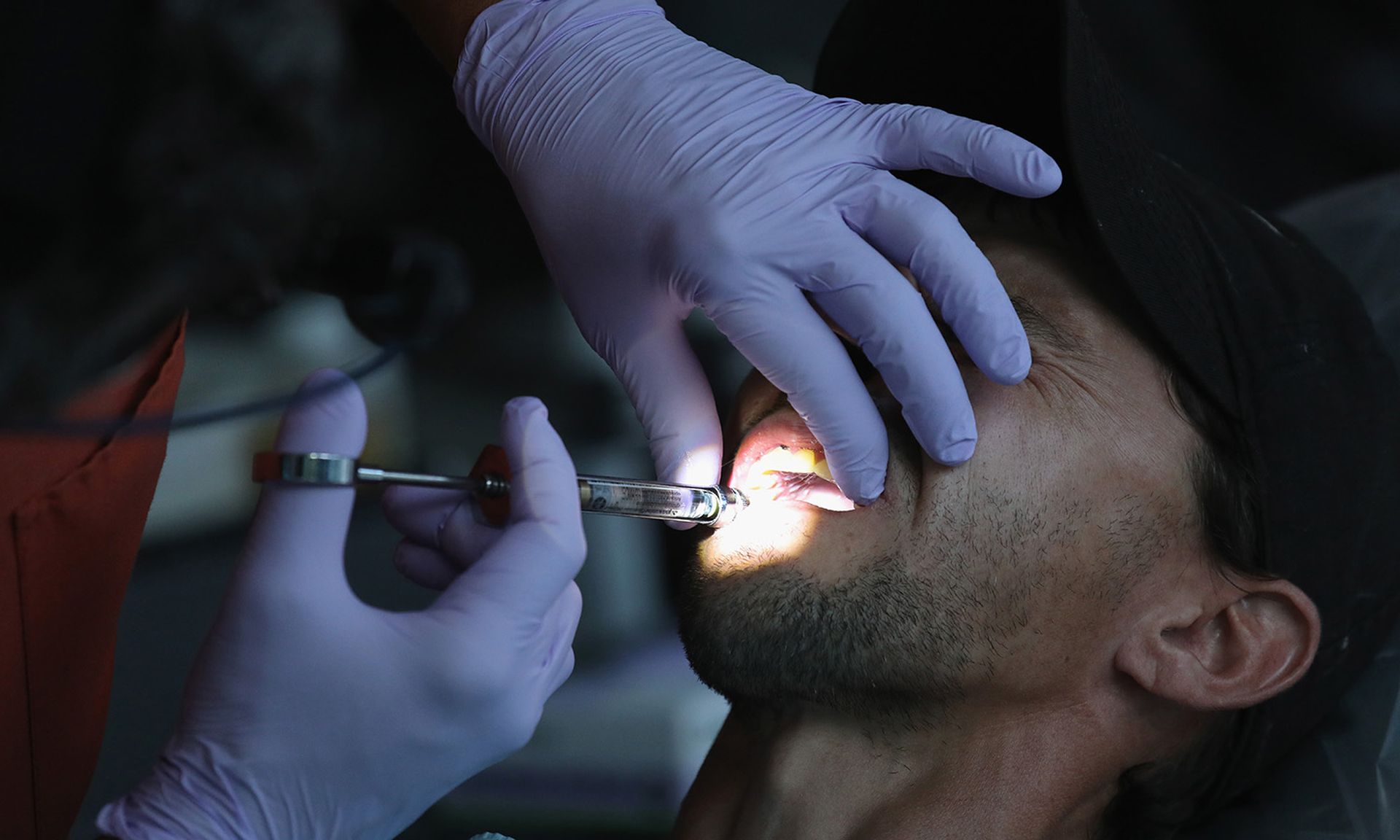A dentist administers oral anesthesia before extracting a tooth at a free health clinic on July 22, 2017, in Wise, Va.  (Photo by John Moore/Getty Images)