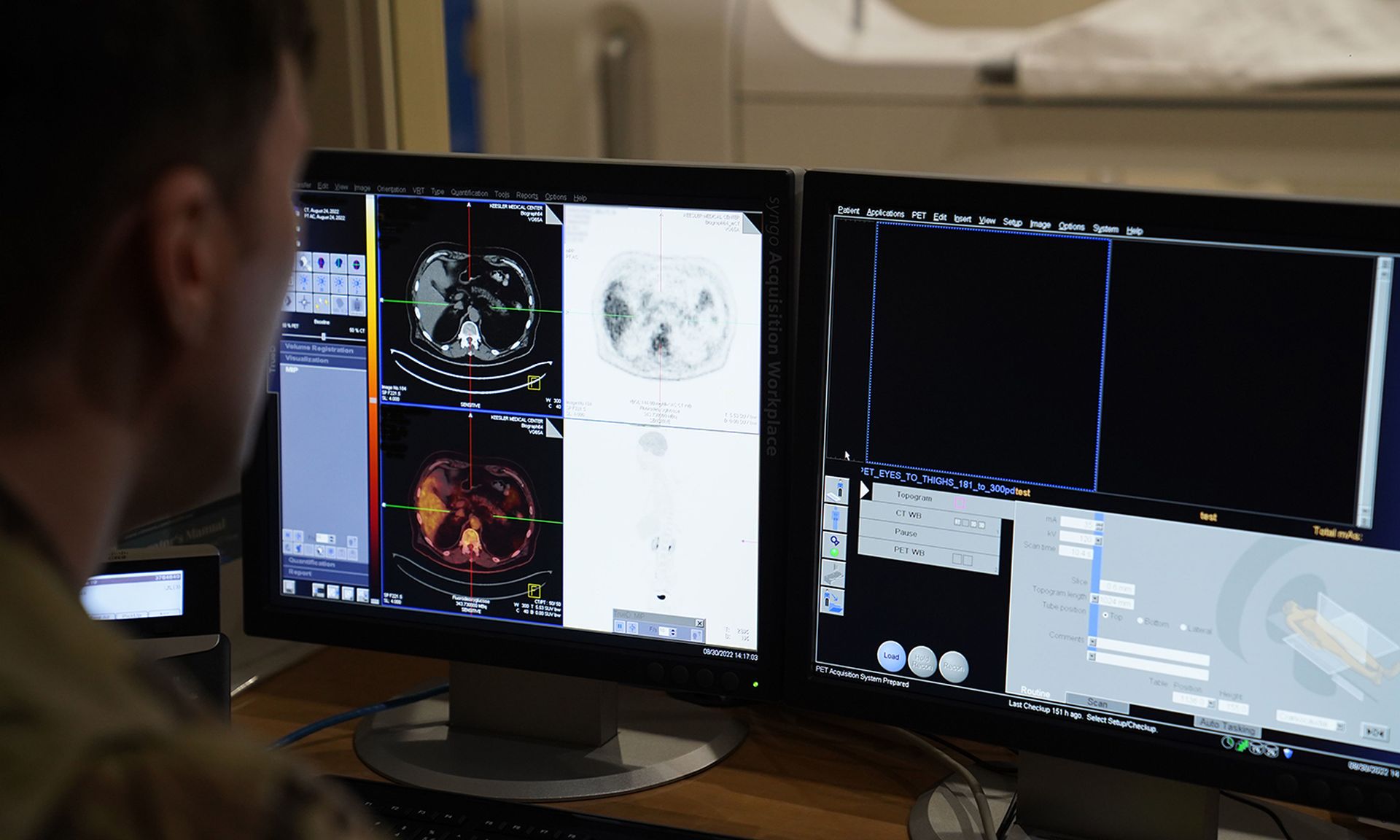 A medical technician monitors a patient procedure on computer screens.