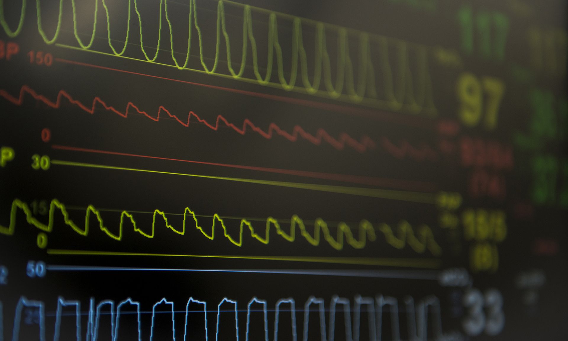 A monitor displays a simulated patient’s medical readings.