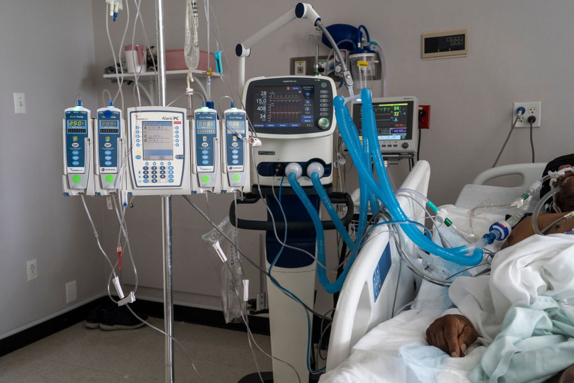 HOUSTON, TX &#8211; JULY 2: (EDITORIAL USE ONLY)  A patient is connected to a ventilator and other medical devices in the COVID-19 intensive care unit at the United Memorial Medical Center on July 2, 2020 in Houston, Texas. COVID-19 cases and hospitalizations have spiked since Texas reopened, pushing intensive-care wards to full capacity and sparki...