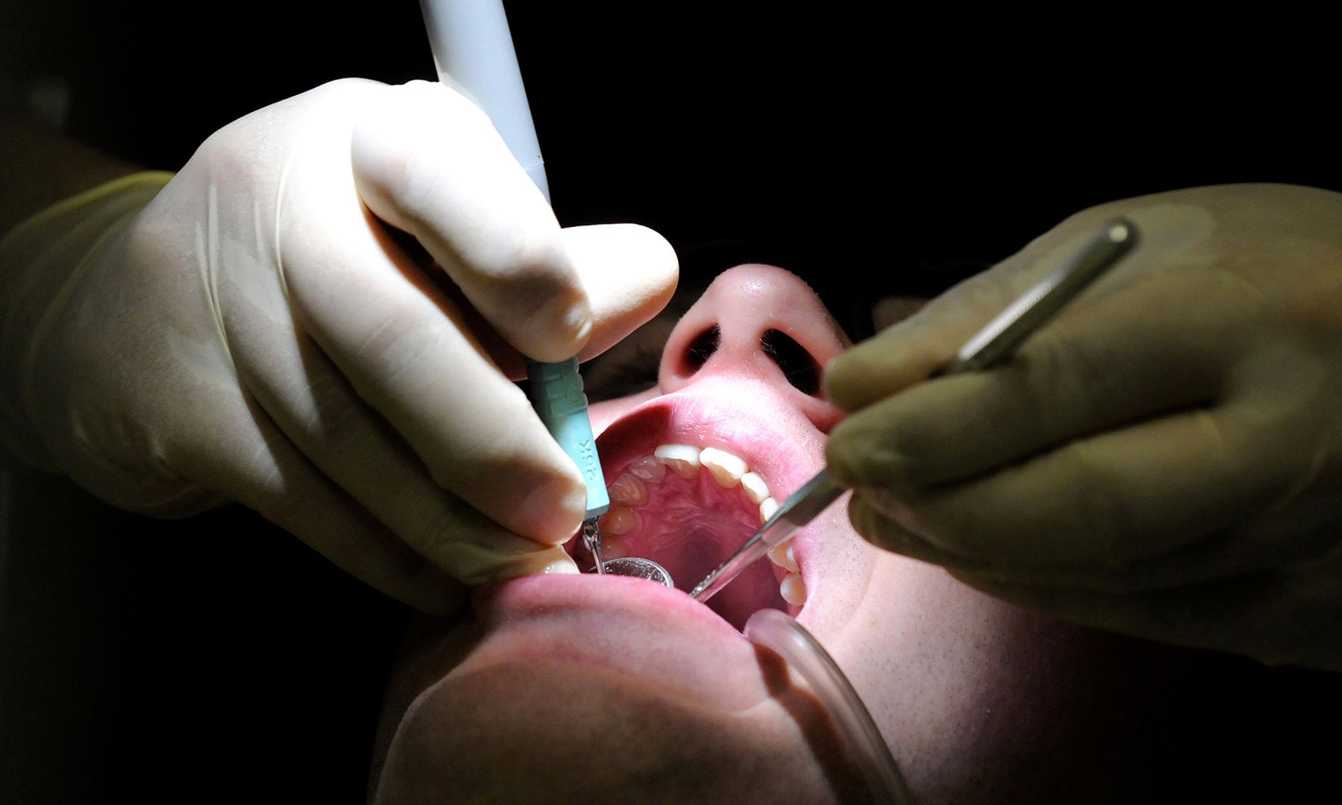 A routine dental cleaning is performed.