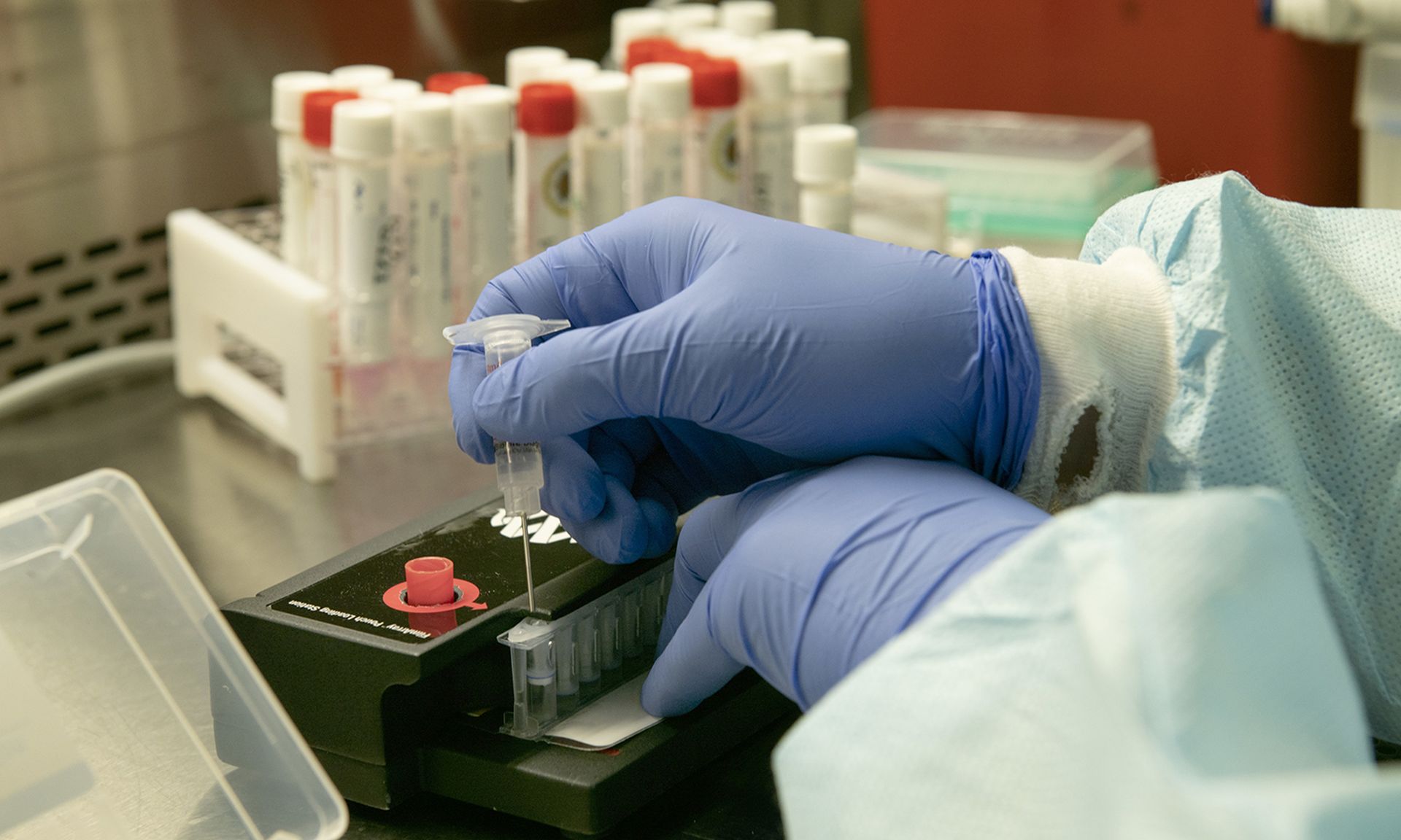 Medical personnel prepares samples for testing